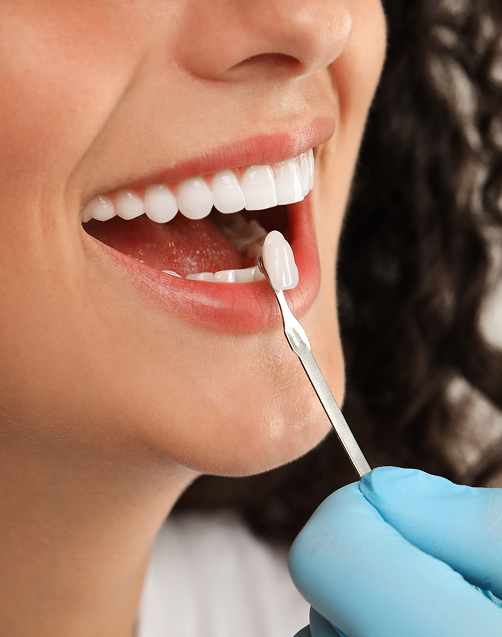 CEREC : pour des restaurations de choix