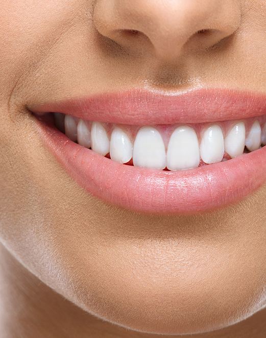 Les aspects traités en dentisterie esthétique Les aspects traités en dentisterie esthétique