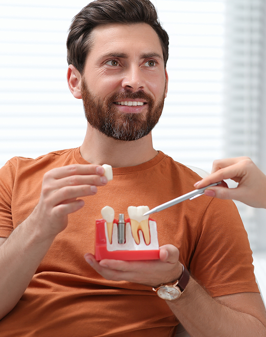 Les avantages des implants dentaires Les avantages des implants dentaires